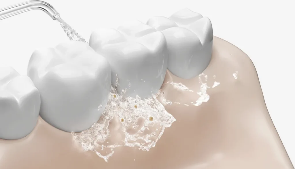Xiaomi Water Flosser 2 (BHR9682EU) Παλμική ροή νερού ανάμεσα στα δόντια